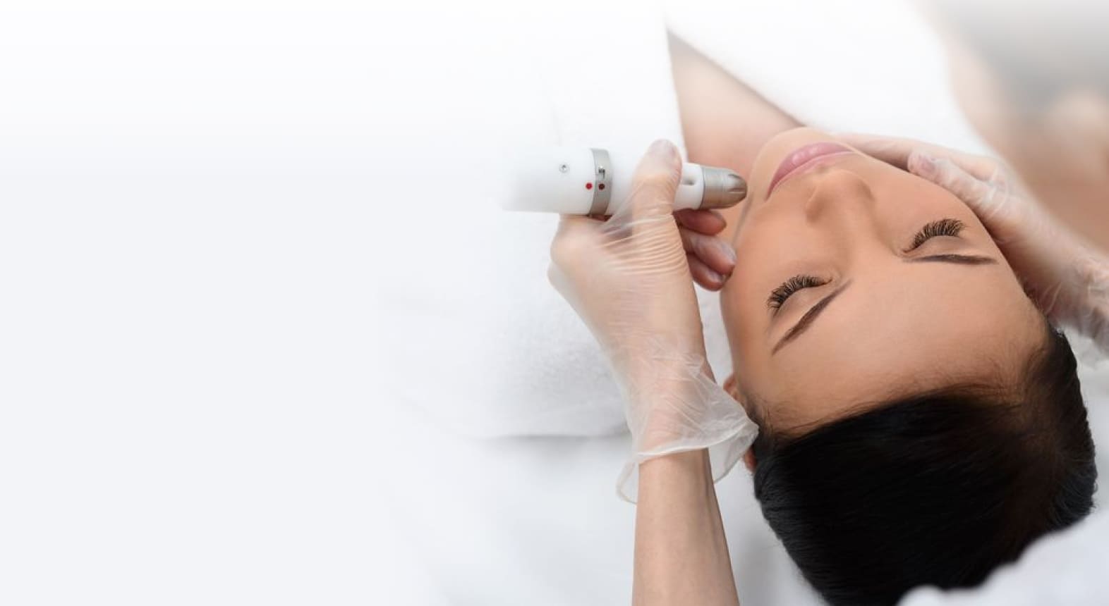 Лазерная коагуляция сосудов