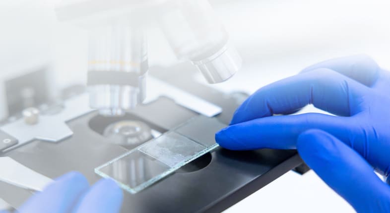 Микроскопическое исследование отделяемого мочеполовых органов (мазок на флору)