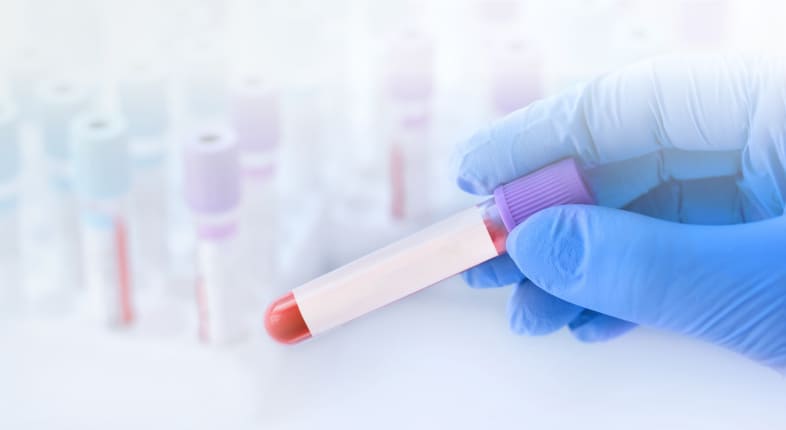 ПЦР. Вирус простого герпеса 1/2 типа